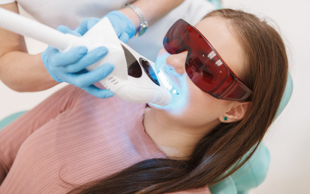 teeth whitening services