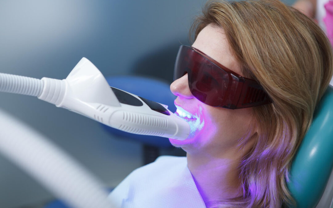 How to Choose the Best Dentist for Teeth Whitening Procedures