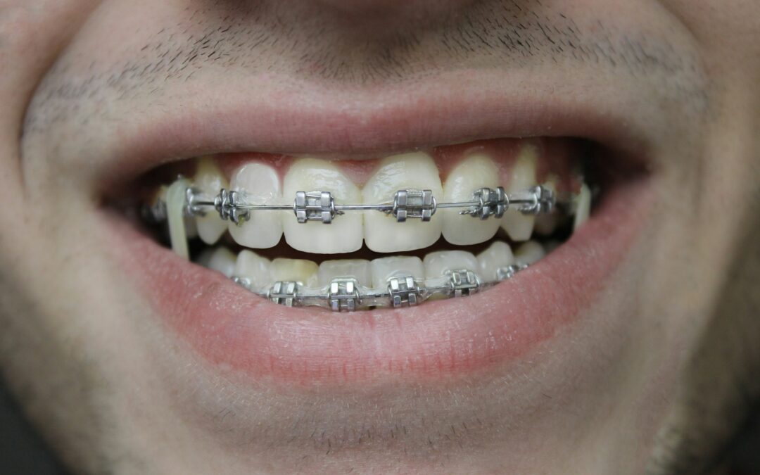 man with braces